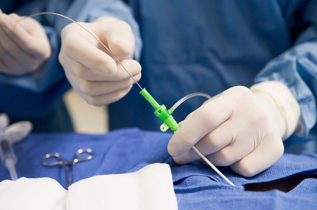 PTFE Capillary Tubing in Medical Industry